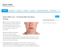 Tablet Screenshot of akne-hilfe.com